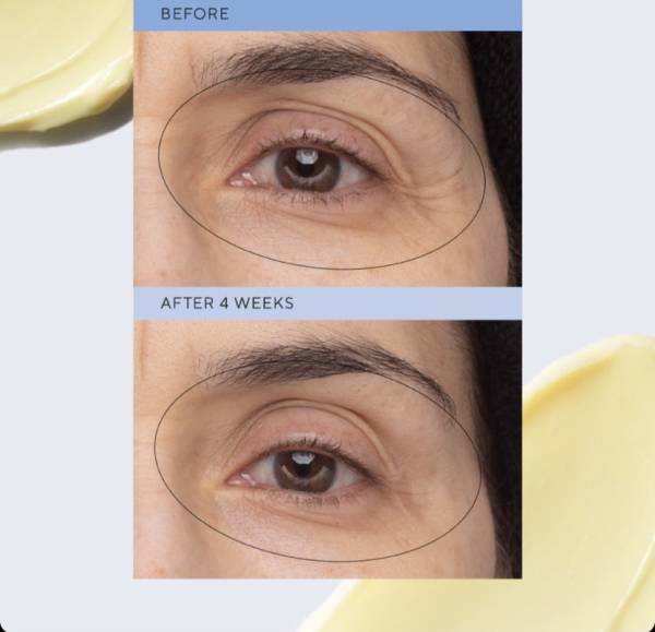 Retinol Eye Renewal NEW